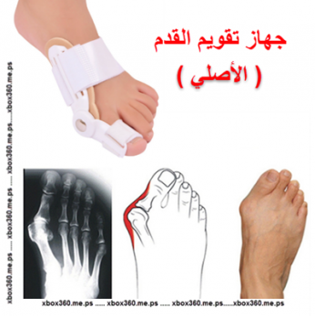 جهاز التقويم للقدم